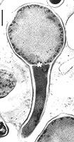 CeanothusVes
