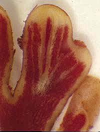 NoduleSectionRHB